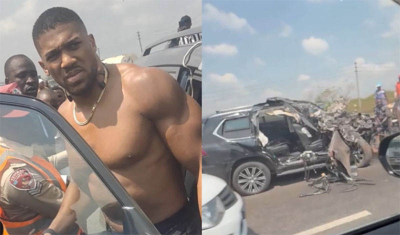 anthony joshua hospital