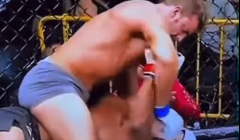 fighter mouthguard 1